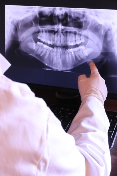 Best Emergency Dentist for Knocked-Out Tooth in Saint John Fisher College, NY