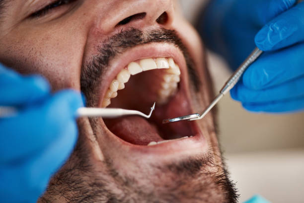 Best Emergency Dental Services for Seniors in Saint John Fisher College, NY
